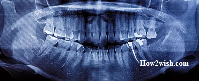 Causes of pathological abrasion of teeth