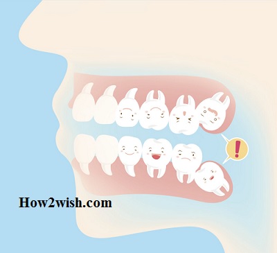 Molars teeth pain