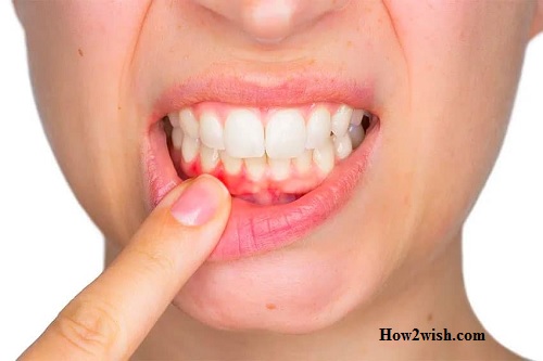 mouth inflammation treatment