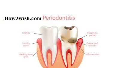 periodontist meaning